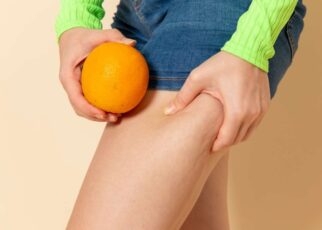 Как бороться с целлюлитом в дома: эффективные методы и советы